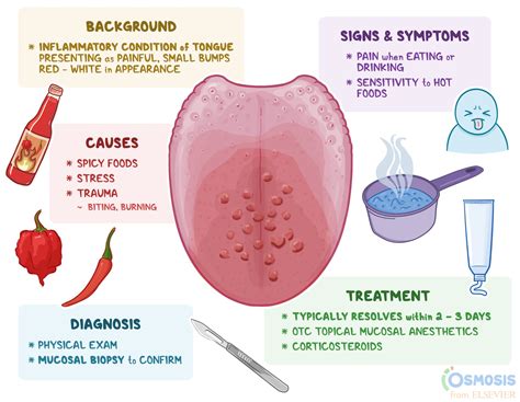 Transient Lingual Papillitis: How to Get Rid of Lie Bumps .